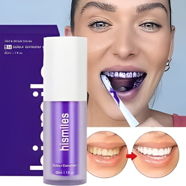 Hismile V34 Colour Corrector Serum – Purple Teeth Whitening Solution for Instant Bright Smile