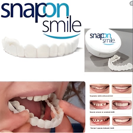Snap-On Smile Silicone Braces – Fake Teeth Decoration Kit | Reusable, Safe & Comfortable Artificial Braces